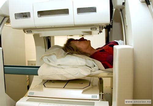 Bilde av skjelettscintigrafi