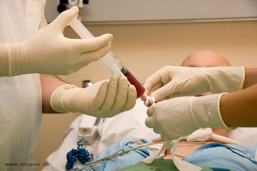 HMAS. Slik utføres tilbakeføring av stamceller, ved kreftbehandling.