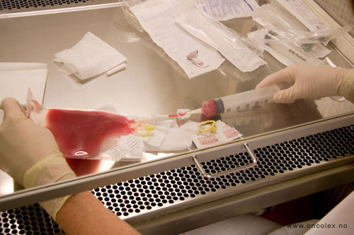 HMAS. Slik utføres tilbakeføring av stamceller, ved kreftbehandling.