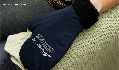 Bruk av kuldehansker og sokker ved kreftbehandling