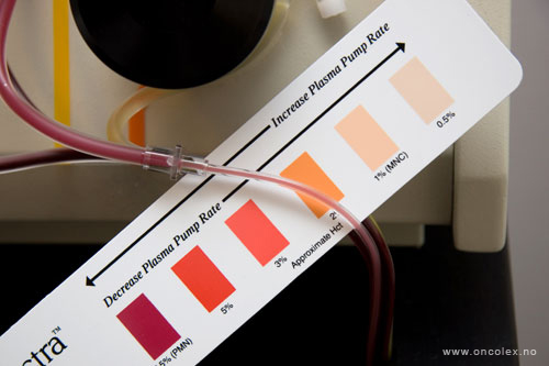 HMAS. Slik utføres stamcellehøsting, ved kreftbehandling.